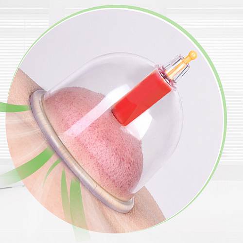 kangzhu-24pcs-magnit-1